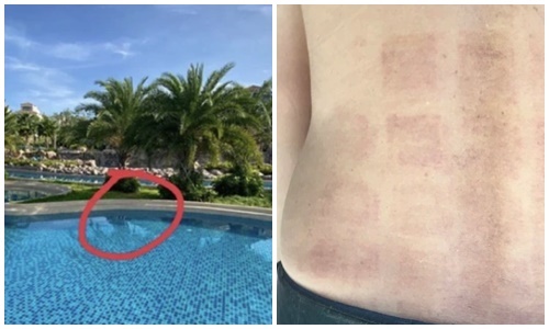 Vụ bé trai người Nhật bị đuối nước ở Phan Thiết: Vết bầm trên lưng luật sư sau 2 ngày thực nghiệm điều tra 