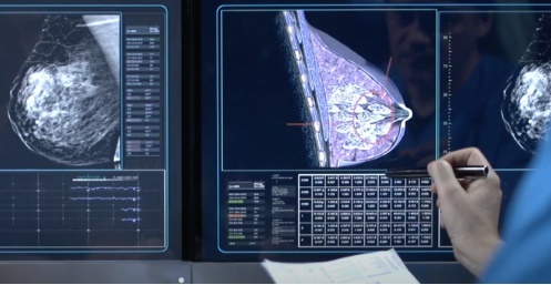 Người phụ nữ vỡ túi nâng ngực gây áp-xe khi đang mang thai 5 tháng