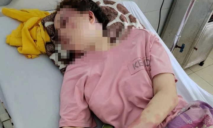 Vụ cô gái bị lột quần áo vì hát cùng người khác: Bạn trai là cán bộ quản lý thị trường