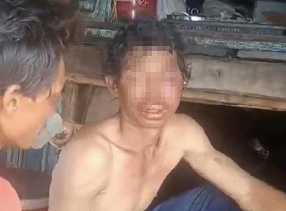 Vụ ngư dân bị hành hạ dã man trên tàu cá: Nạn nhân đã vào đất liền