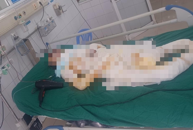 Vụ 3 con gái đổ xăng đốt nhà mẹ ruột ở Hưng Yên: Hé lộ tình trạng của người mẹ