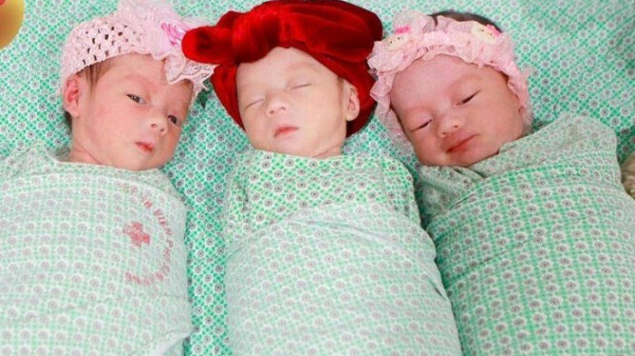 Mổ đẻ thành công cho sản phụ mang 3 thai cùng trứng hiếm gặp 