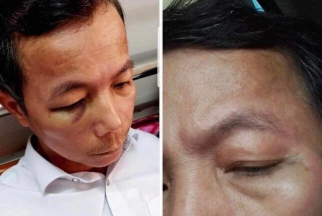 Vụ hiệu trưởng đánh hiệu phó nhập viện: Cả hai bị xử phạt hành chính