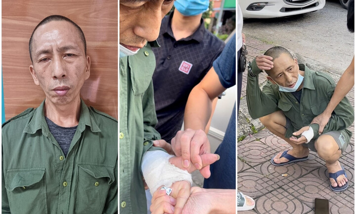 Tin tức thời sự mới nóng nhất hôm nay 6/9: Người đàn ông vờ bó bột tay để giấu ma túy