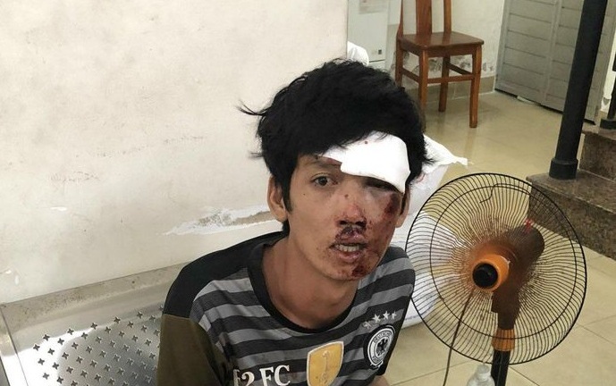 Tin tức thời sự mới nóng nhất hôm nay 16/10: Bị truy đuổi, tên cướp tông vào dải phân cách bất tỉnh