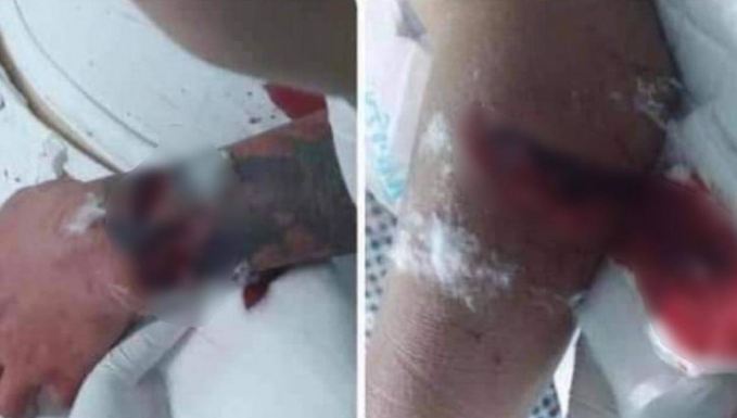 Tạm giữ hình sự nam thanh niên chém bố và cậu của bạn gái trong ngày ra mắt