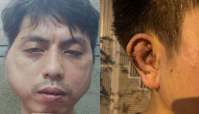 Hà Nội: Khởi tố nhóm đối tượng đánh nhân viên quán nướng biến dạng mặt