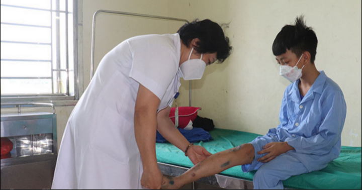 Không chủ quan với bệnh viêm da mủ trong mùa hè