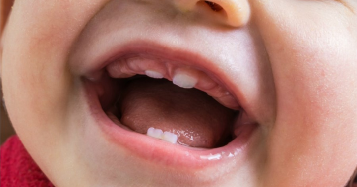 Nhật Bản sẽ phát triển loại thuốc giúp răng mọc lại nhiều lần