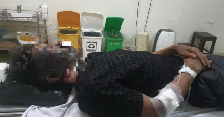 Đi kích cá đêm, 2 người đàn ông ở Ninh Bình bị sét đánh