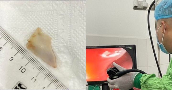 Người đàn ông gặp nguy hiểm sau khi ăn trưa với thịt lợn