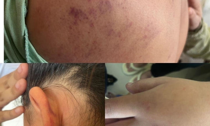 Phú Yên: Xác minh vụ nữ sinh 15 tuổi bị lột đồ, hành hung dã man suốt 2 giờ đồng hồ