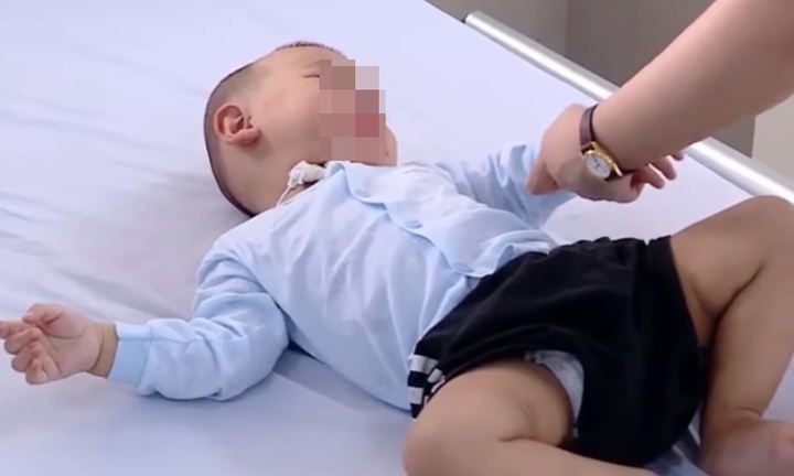 Cấp cứu kịp thời bé trai 10 tháng tuổi nguy kịch sau khi ăn cháo hầm xương