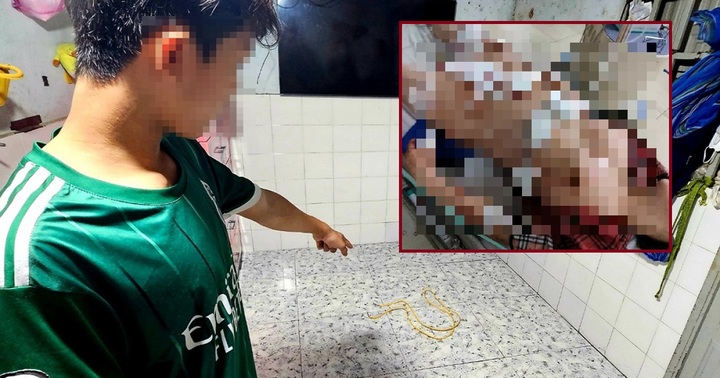 Tin tức an ninh hình sự 3/9: Người phụ nữ bị chồng bạo hành dã man ở Bình Dương