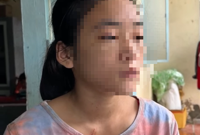 Vụ thiếu nữ ở Cà Mau bị đánh dã man: Nghi phạm khai bắt nạn nhân ăn thằn lằn sống