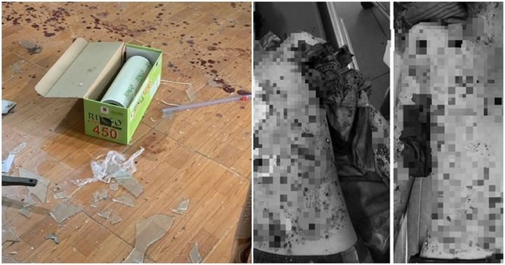 Tự chế pháo nổ, 2 học sinh lớp 9 ở Lâm Đồng nguy kịch phải thở máy