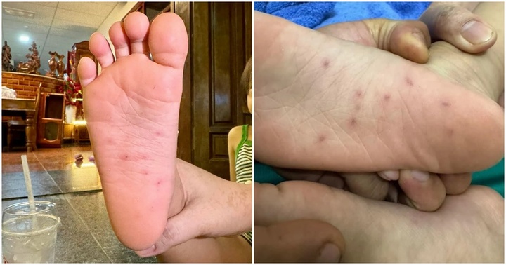 Vụ 2 bé ở Bình Định nghi bị giáo viên mầm non bạo hành: Công an vào cuộc điều tra