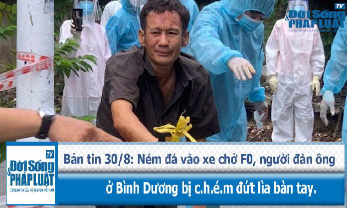 Ném đá vào xe chở F0, người đàn ông ở Bình Dương bị chém đứt lìa bàn tay