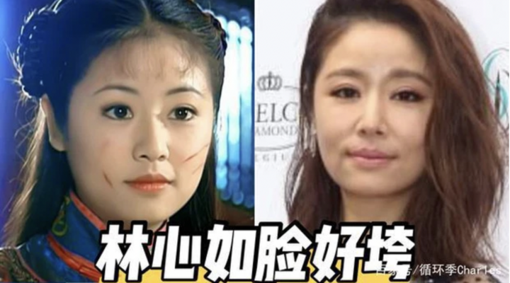 Báo Trung tiết lộ Lâm Tâm Như mắc bệnh lạ, lộ rõ dấu hiệu lão hóa nhanh ở tuổi 45