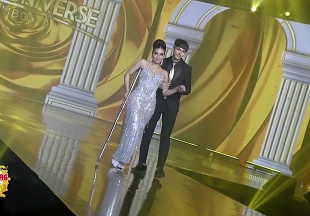 Thí sinh Hoa hậu Hoàn vũ Campuchia chống nạng khi trình diễn 