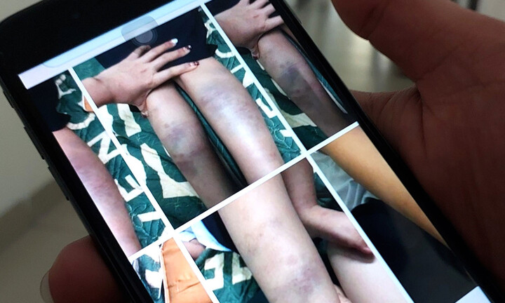 Vụ học sinh lớp 1 bị đánh ở Đà Nẵng: Công an vào cuộc, giáo viên chủ nhiệm dừng đứng lớp