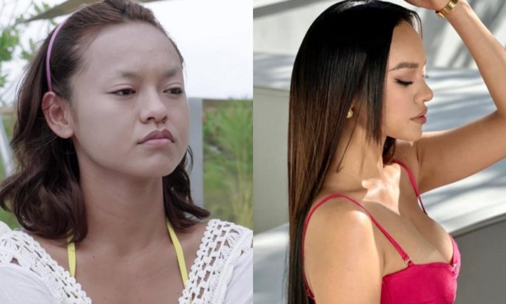 Mai Ngô thừa nhận can thiệp phẫu thuật thẩm mỹ