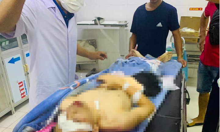 Hà Tĩnh: Nam sinh bị mất bàn tay sau tiếng nổ lớn