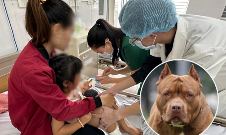 Bé gái 4 tuổi bị chó Pitbull dại tấn công: Phải khâu hàng chục mũi trên mặt