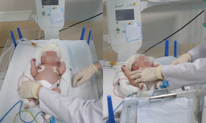 Mới đẻ được 45 ngày, trẻ sơ sinh mắc căn bệnh nguy hiểm về rối loạn chuyển hóa