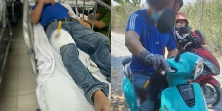 Lý do người đàn ông tự đâm dao vào chân, hoang báo bị cướp