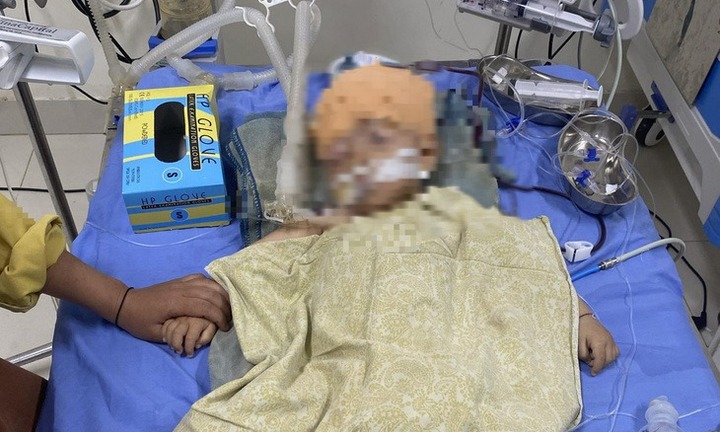 Vụ bé trai 1 tuổi chấn thương não ở trường mầm non: Tiết lộ bất ngờ