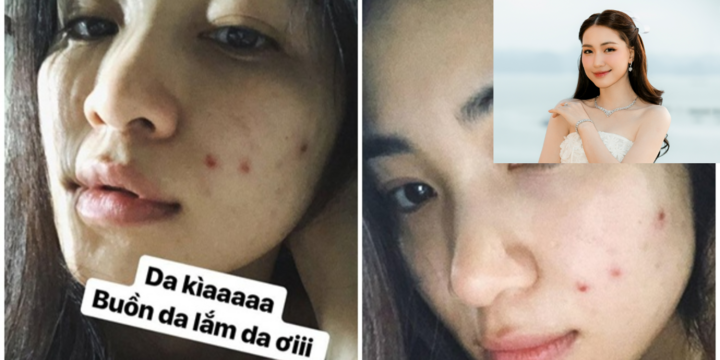 Loại nước giải nhiệt giúp Hòa Minzy