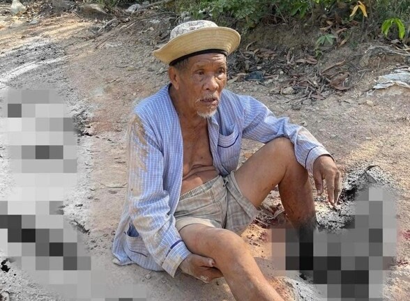 Truy tìm chiếc xe tông một cụ ông bị thương nặng rồi bỏ trốn