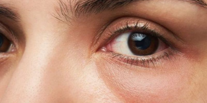 Phát hiện dấu hiệu này buổi sáng, chú ý ngay kẻo suy thận