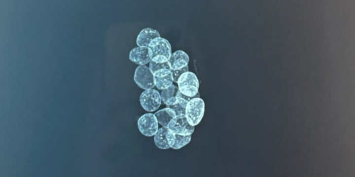 Bé 3 tuổi ngộ độc chì vì thói quen 