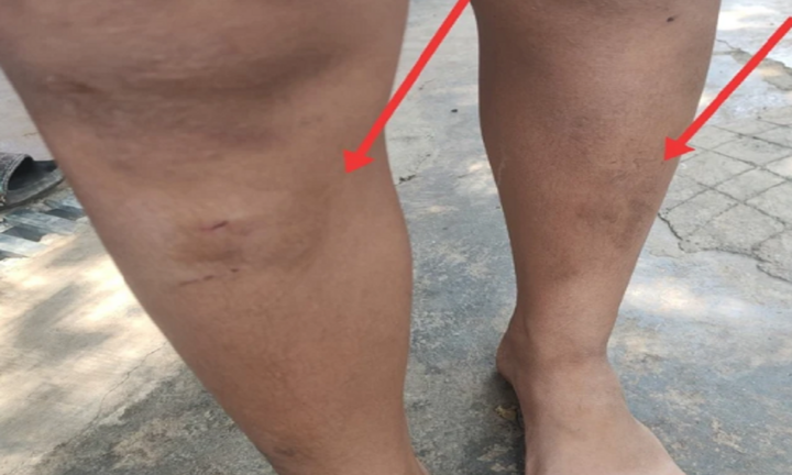 Đắk Lắk: Xót xa 5 em nhỏ bị hàng xóm đánh đập, bắt quỳ giữa đường