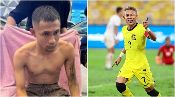 Đội trưởng tuyển Malaysia bị kẻ lạ mặt tạt axit, bỏng cấp độ 2