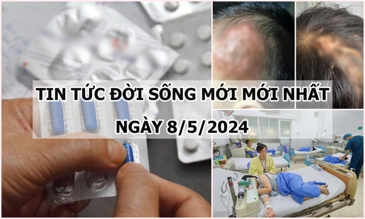 Tin tức đời sống ngày 8/5/2024: Căn bệnh khiến bé trai bị tổn thương ở da đầu