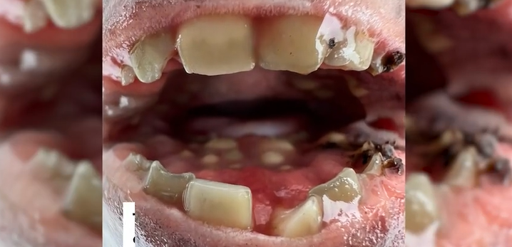 Kỳ lạ con cá 7,5kg có hàm răng giống con người