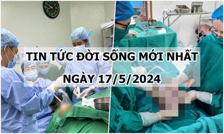 Tin tức đời sống ngày 17/5/2024: Xương gà nhiều ngạnh cắm vào thực quản cụ ông