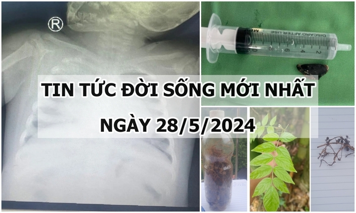 Tin tức đời sống ngày 28/5/2024: Bé 3 tuổi bị viêm phổi nặng do cúm A/H1
