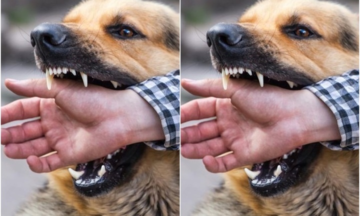 Bị chó cắn, bé trai 7 tuổi tử vong do bệnh dại 