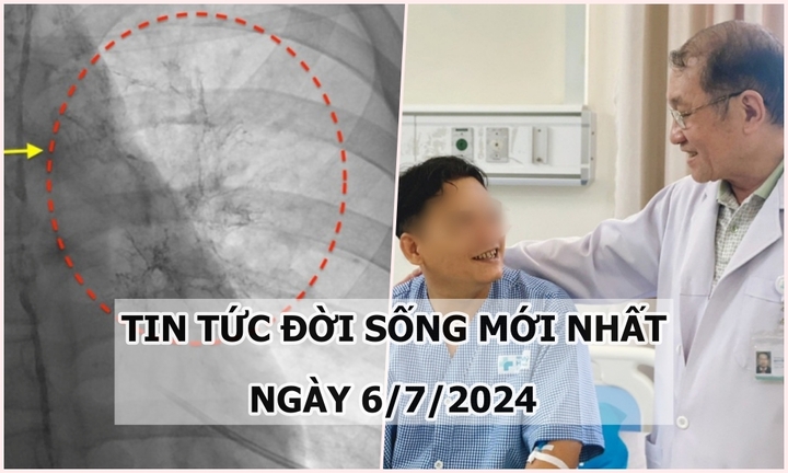 Tin tức đời sống ngày 6/7/2024: Đau ngực kèm khó thở, phát hiện bị bệnh hiếm gặp