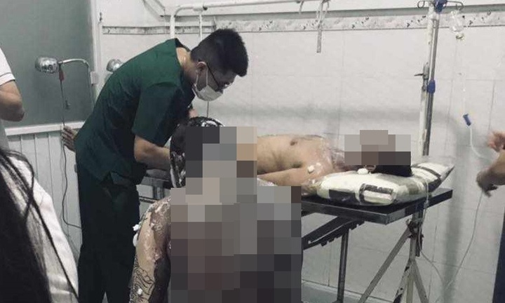 Bình Dương: Nổ bồn chứa mùn cưa, ít nhất 9 công nhân bị thương