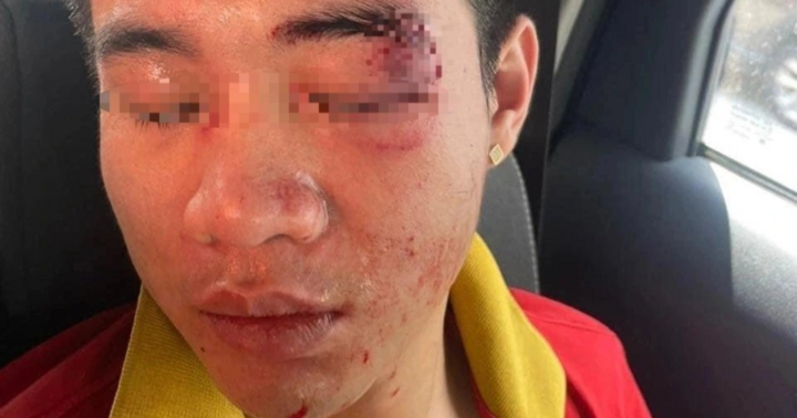 Điều tra vụ nam nhân viên nhà xe ở Hà Nội bị đánh hội đồng