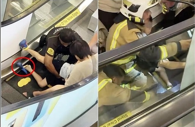 Bé trai 9 tuổi bị kẹp chân vào thang cuốn, cha mẹ cần lưu ý gì để bảo vệ trẻ?