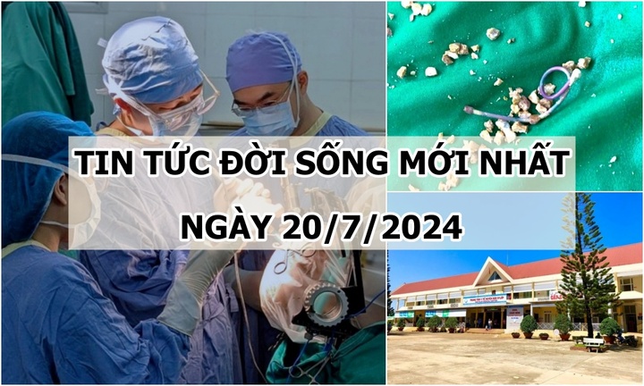 Tin tức đời sống ngày 20/7/2024: Dị vật bị quên 5 năm trong cơ thể người phụ nữ