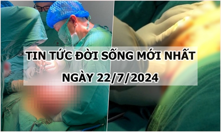 Tin tức đời sống ngày 22/7/2024: Khối u chiếm gần hết ổ bụng người phụ nữ