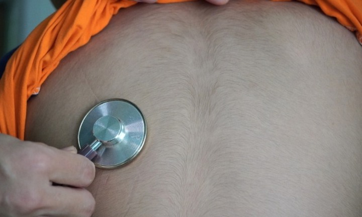 Bé trai mọc lông rậm toàn thân, đưa đi khám mới biết nguyên nhân không ngờ