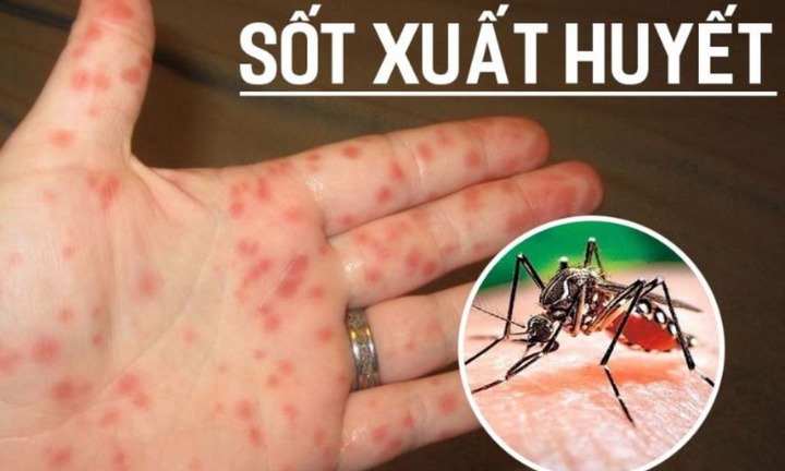 TP.HCM: Gần 4.600 trường hợp mắc sốt xuất huyết, người dân cần chủ động phòng bệnh